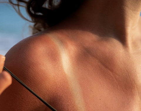 El bronceado saludable no existe